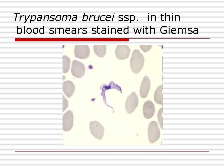 Trypansoma brucei ssp. in thin blood smears stained with Giemsa 