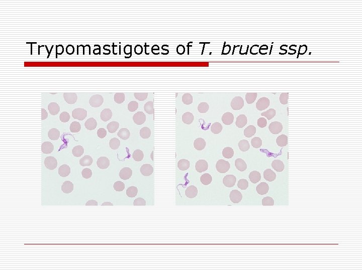 Trypomastigotes of T. brucei ssp. 