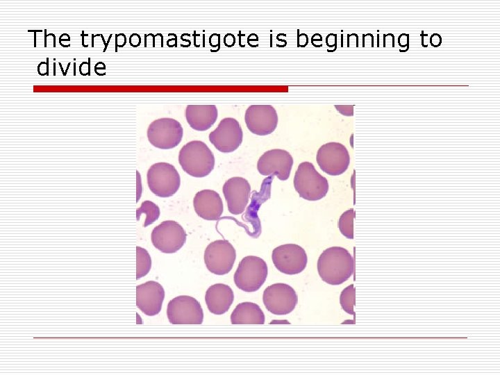 The trypomastigote is beginning to divide 