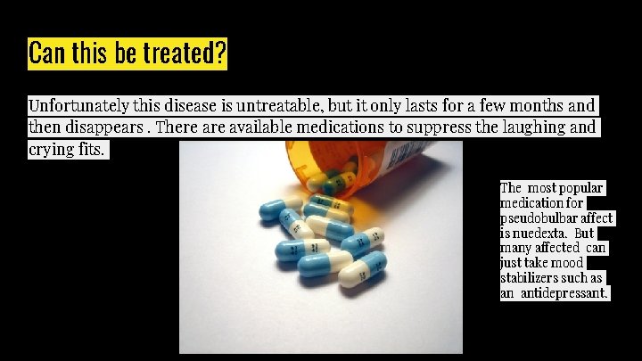 Can this be treated? Unfortunately this disease is untreatable, but it only lasts for