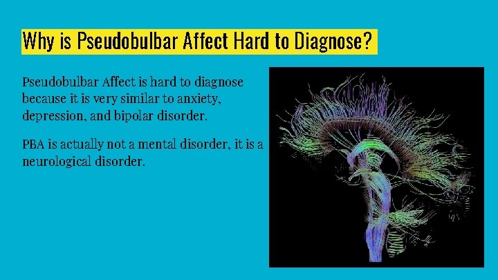 Why is Pseudobulbar Affect Hard to Diagnose? Pseudobulbar Affect is hard to diagnose because