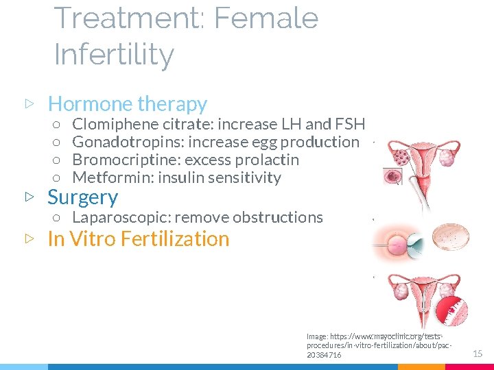 Treatment: Female Infertility ▷ Hormone therapy ○ ○ Clomiphene citrate: increase LH and FSH