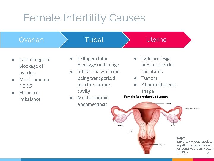 Female Infertility Causes Tubal Ovarian ● ● ● Lack of eggs or blockage of