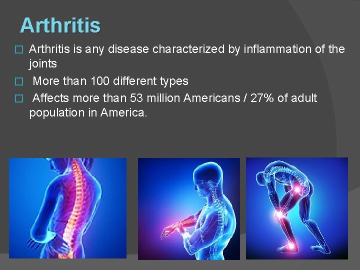 Arthritis is any disease characterized by inflammation of the joints � More than 100