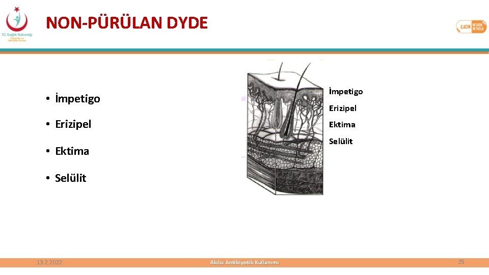 NON-PÜRÜLAN DYDE • İmpetigo • Erizipel • Ektima İmpetigo Erizipel Ektima Selülit • Selülit