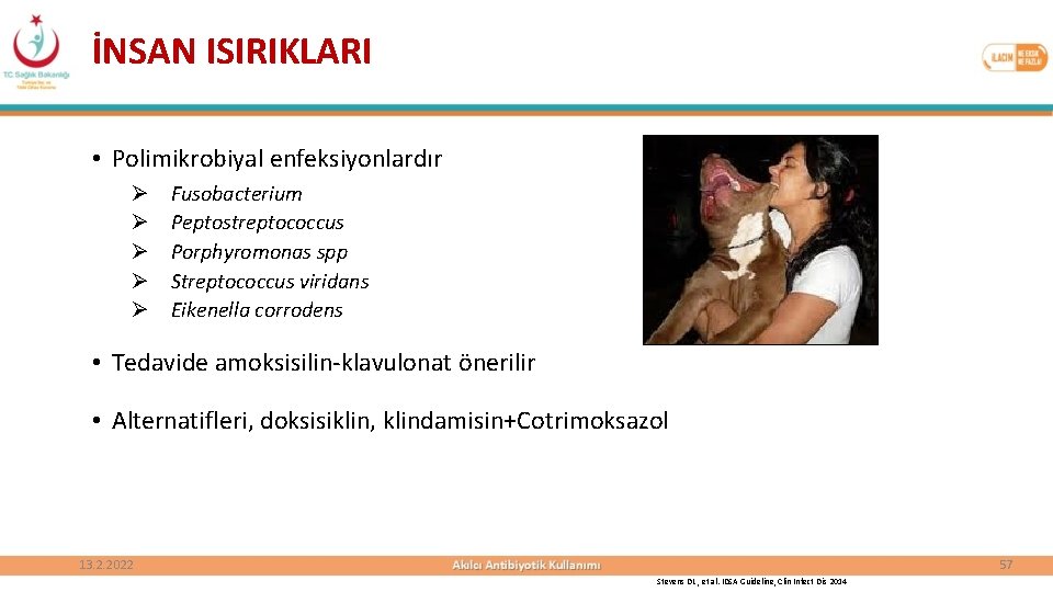 İNSAN ISIRIKLARI • Polimikrobiyal enfeksiyonlardır Ø Ø Ø Fusobacterium Peptostreptococcus Porphyromonas spp Streptococcus viridans