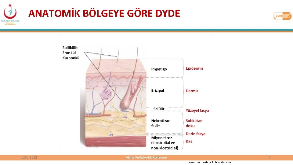 ANATOMİK BÖLGEYE GÖRE DYDE 13. 2. 2022 7 Dryden SM. J Antimicrob Chemother 2010