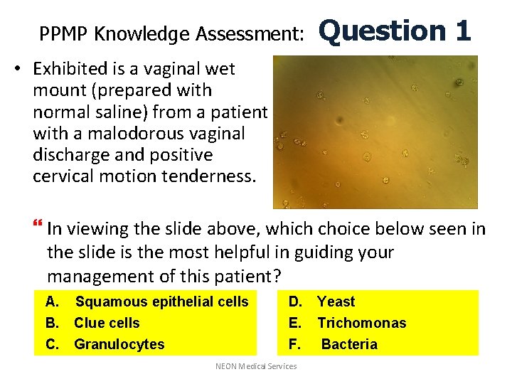 PPMP Knowledge Assessment: Question 1 • Exhibited is a vaginal wet mount (prepared with