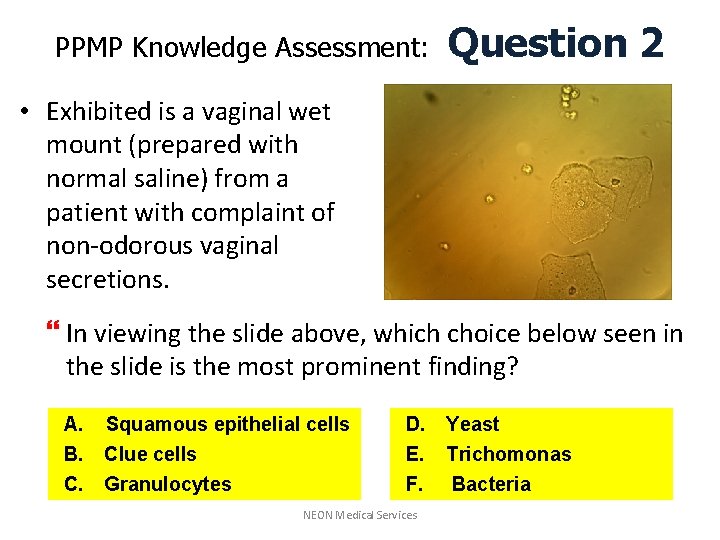 PPMP Knowledge Assessment: Question 2 • Exhibited is a vaginal wet mount (prepared with