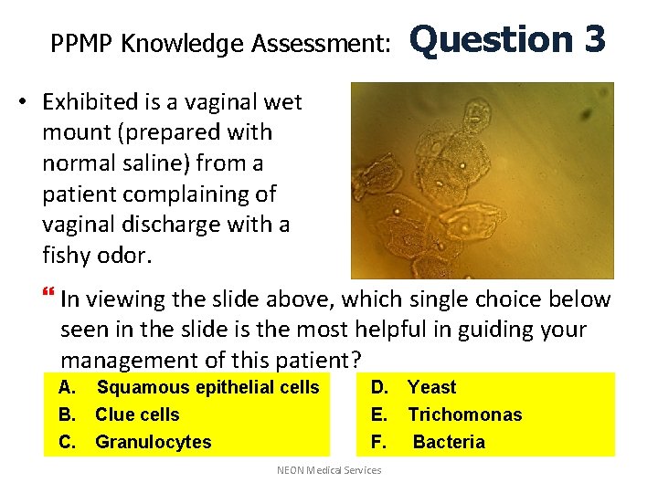 PPMP Knowledge Assessment: Question 3 • Exhibited is a vaginal wet mount (prepared with