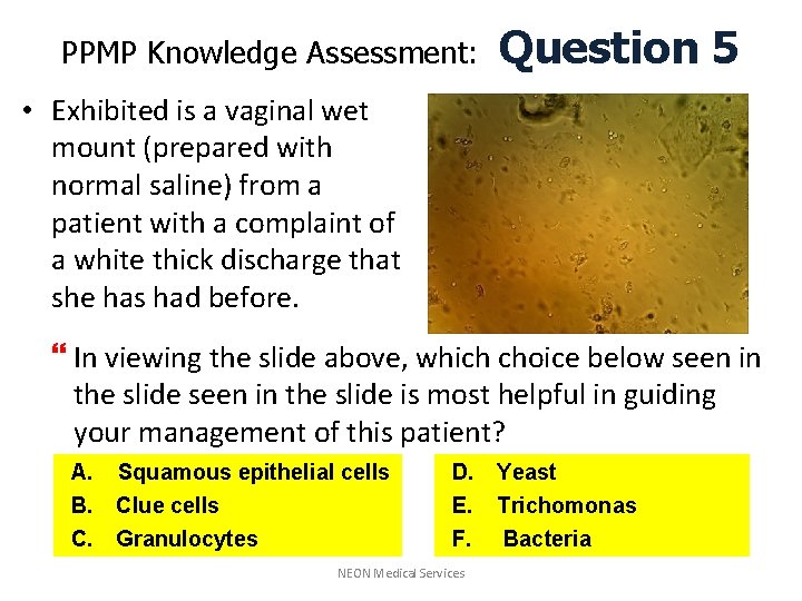 PPMP Knowledge Assessment: Question 5 • Exhibited is a vaginal wet mount (prepared with