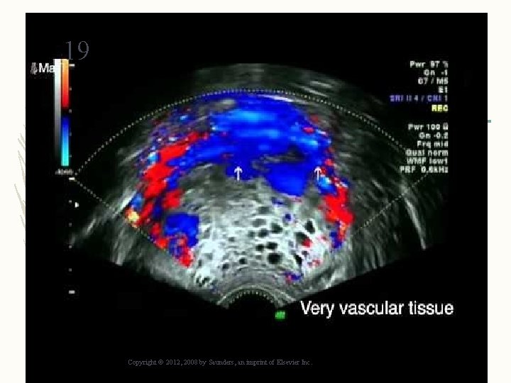 19 Copyright © 2012, 2008 by Saunders, an imprint of Elsevier Inc. 