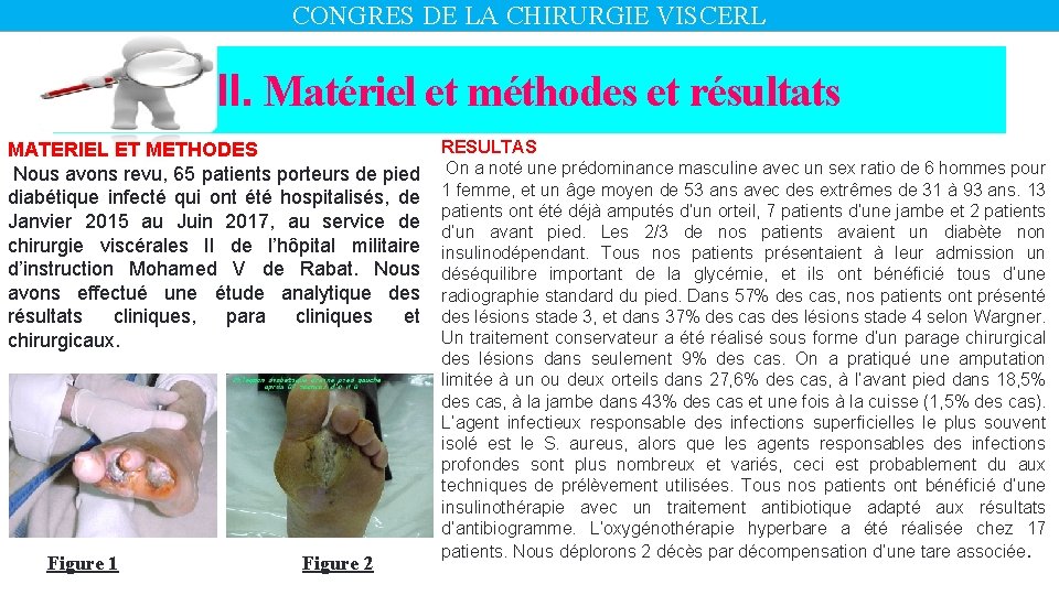 CONGRES DE LA CHIRURGIE VISCERL II. Matériel et méthodes et résultats MATERIEL ET METHODES