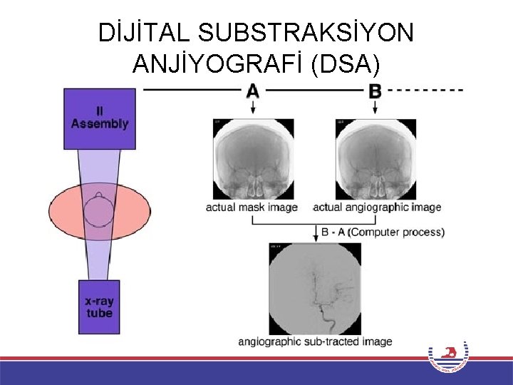 DİJİTAL SUBSTRAKSİYON ANJİYOGRAFİ (DSA) 