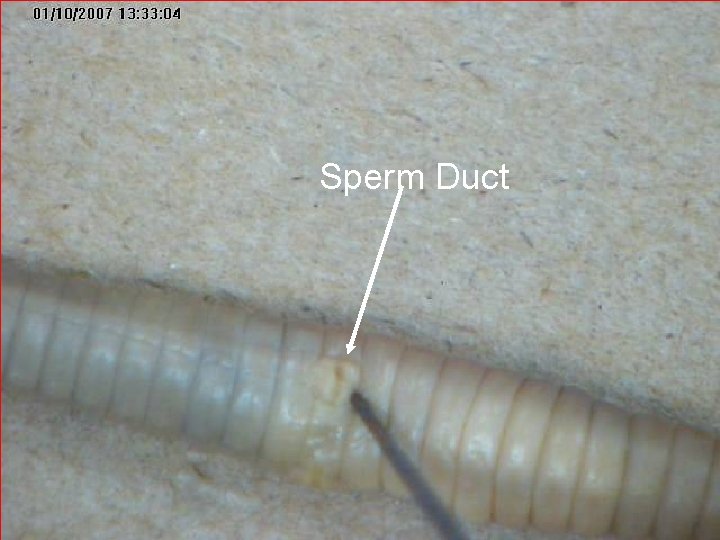 Sperm Duct Sperm Duct