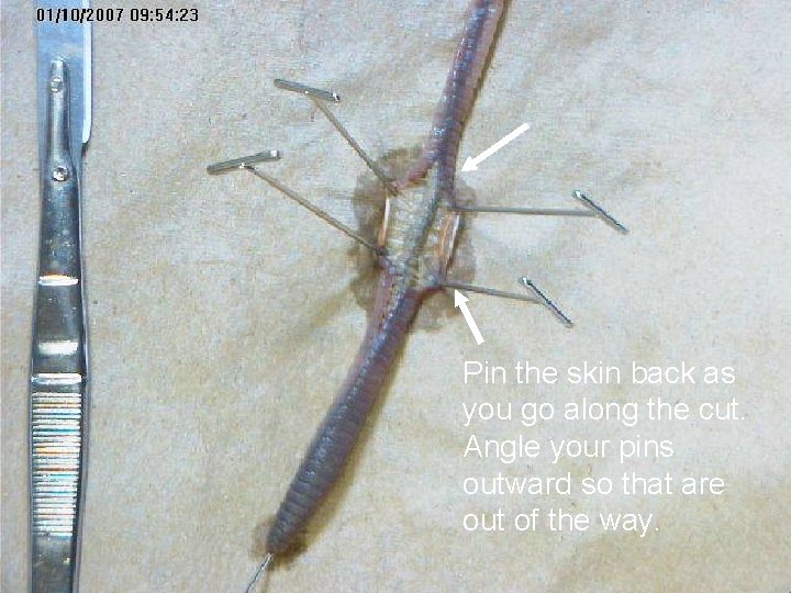 Pin the skin back as you go along the cut. Angle your pins outward Pin the skin back as you go along the cut. Angle your pins outward