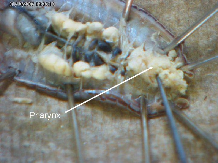 Pharynx Pharynx