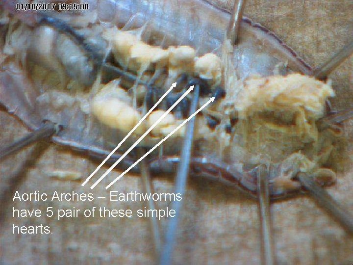 Aortic Arches – Earthworms have 5 pair of these simple hearts. Aortic Arches – Earthworms have 5 pair of these simple hearts.