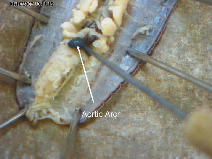 Aortic Arch Aortic Arch
