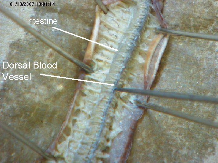 Intestine Dorsal Blood Vessel Intestine Dorsal Blood Vessel