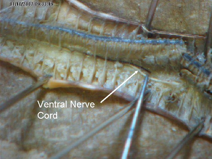 Ventral Nerve Cord Ventral Nerve Cord