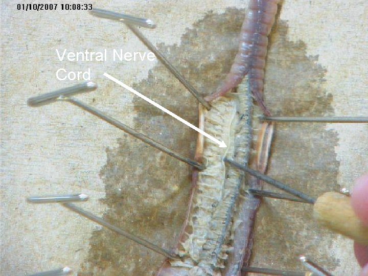 Ventral Nerve Cord Ventral Nerve Cord