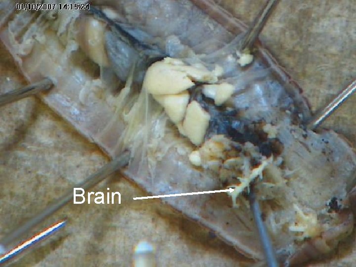 Brain Brain