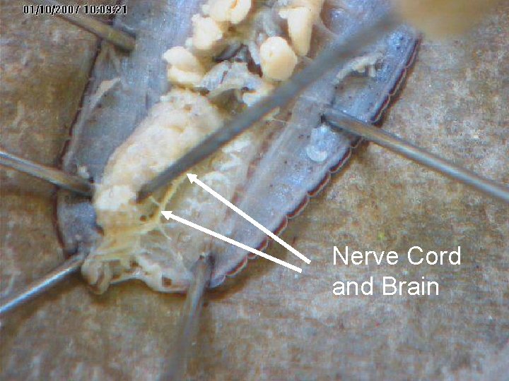 Nerve Cord and Brain Nerve Cord and Brain