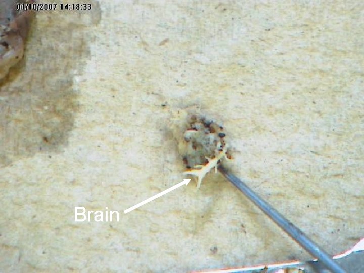 Brain Brain