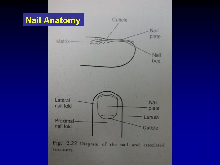 Nail Anatomy 11 
