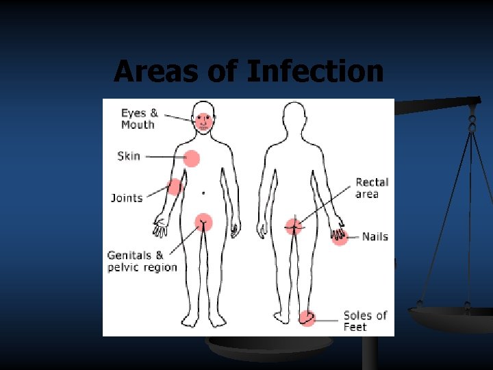 Areas of Infection 