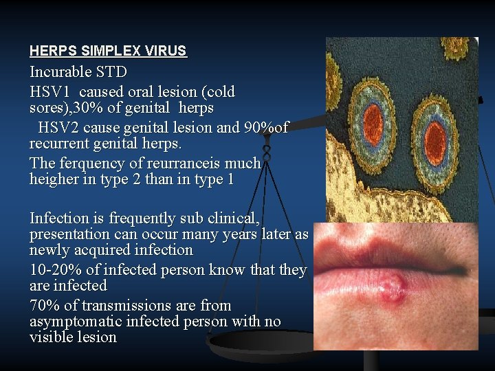 HERPS SIMPLEX VIRUS Incurable STD HSV 1 caused oral lesion (cold sores), 30% of