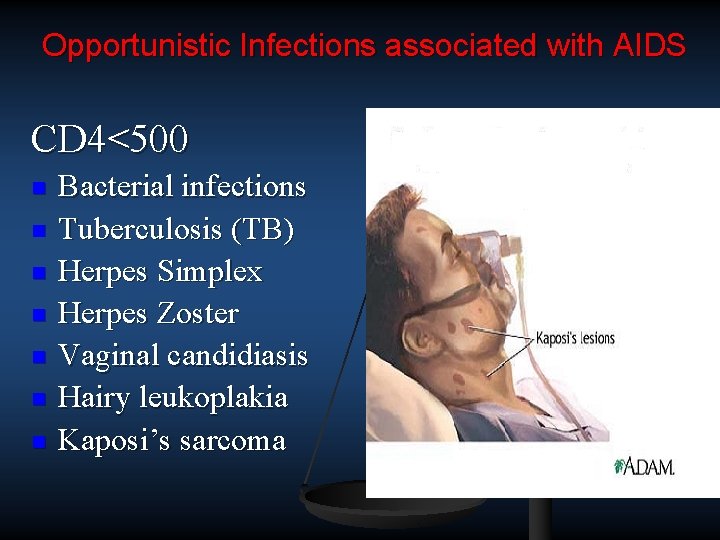 Opportunistic Infections associated with AIDS CD 4<500 n n n n Bacterial infections Tuberculosis