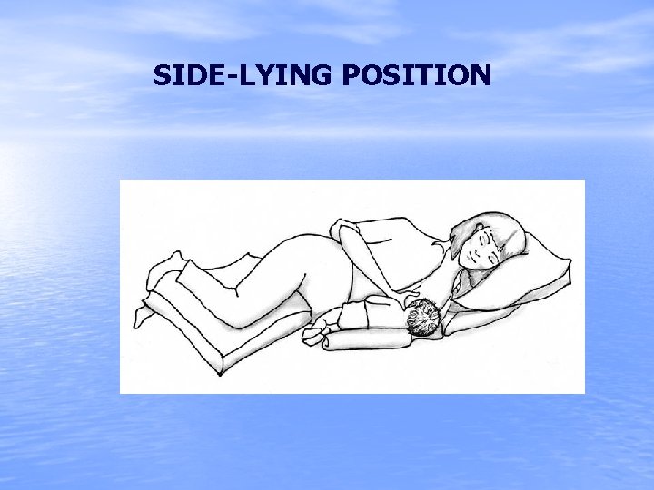 SIDE-LYING POSITION 