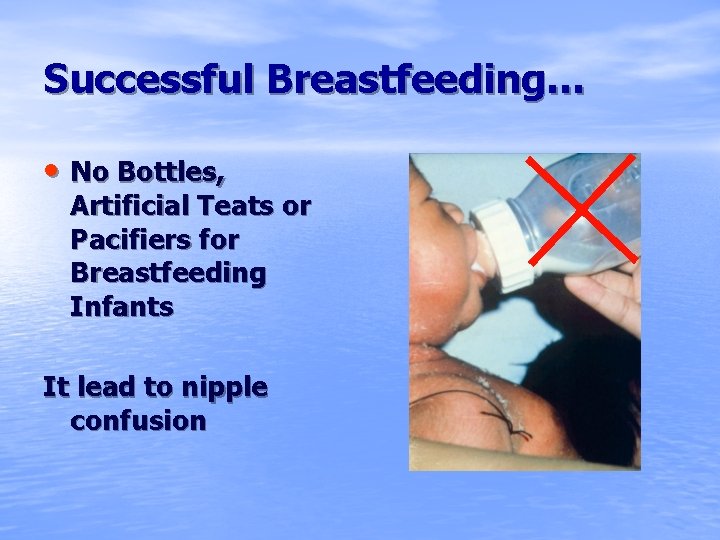 Successful Breastfeeding… • No Bottles, Artificial Teats or Pacifiers for Breastfeeding Infants It lead