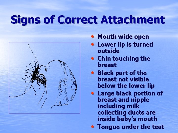 Signs of Correct Attachment • Mouth wide open • Lower lip is turned •
