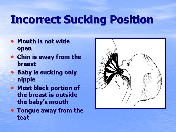 Incorrect Sucking Position • Mouth is not wide • • open Chin is away