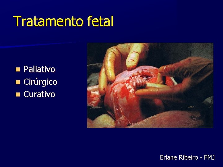 Tratamento fetal Paliativo n Cirúrgico n Curativo n Erlane Ribeiro - FMJ 