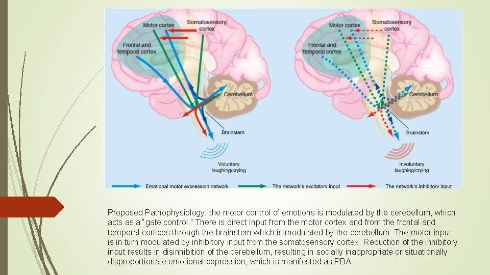 Proposed Pathophysiology: the motor control of emotions is modulated by the cerebellum, which acts
