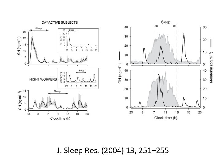 J. Sleep Res. (2004) 13, 251– 255 J. Sleep Res. (2004) 13, 251– 255