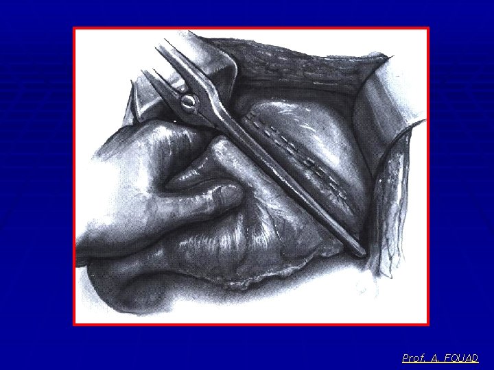 Prof. A. FOUAD 