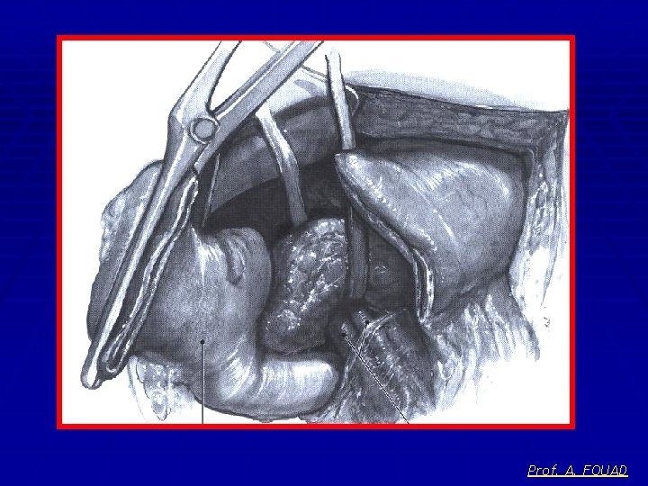 Prof. A. FOUAD 