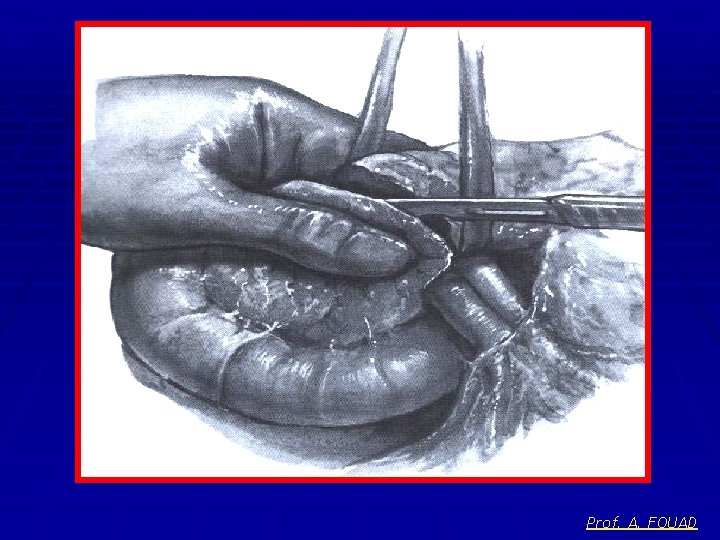 Prof. A. FOUAD 