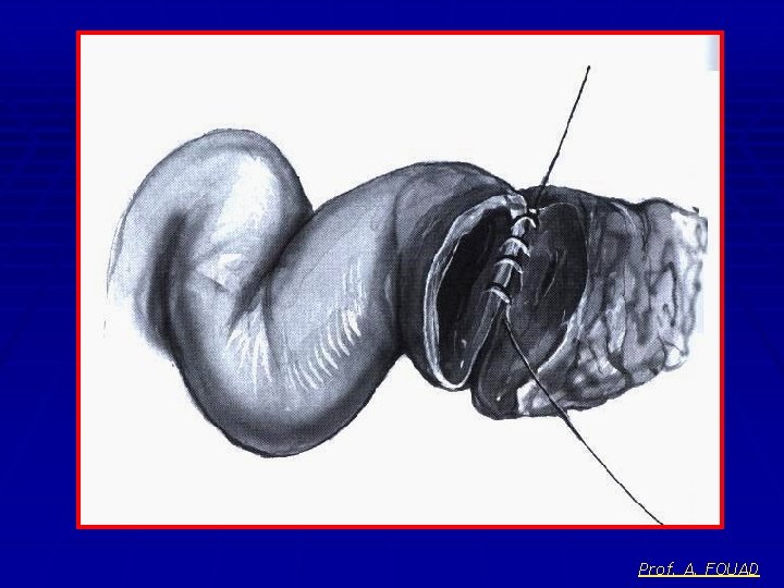 Prof. A. FOUAD 