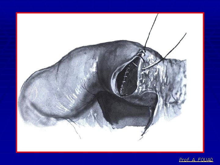 Prof. A. FOUAD 
