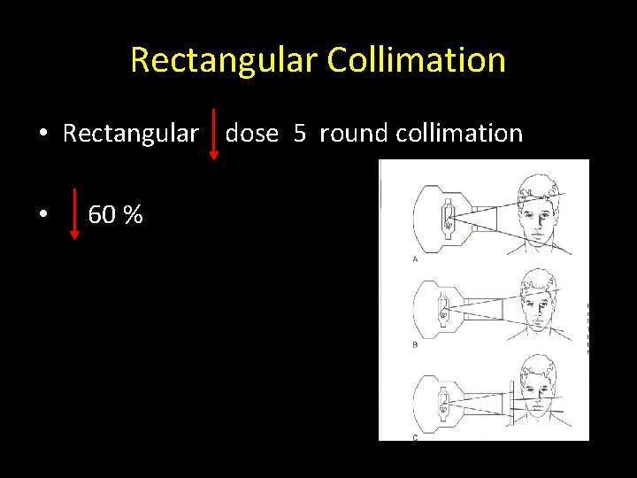 Rectangular Collimation • Rectangular dose 5 round collimation • 60 % 