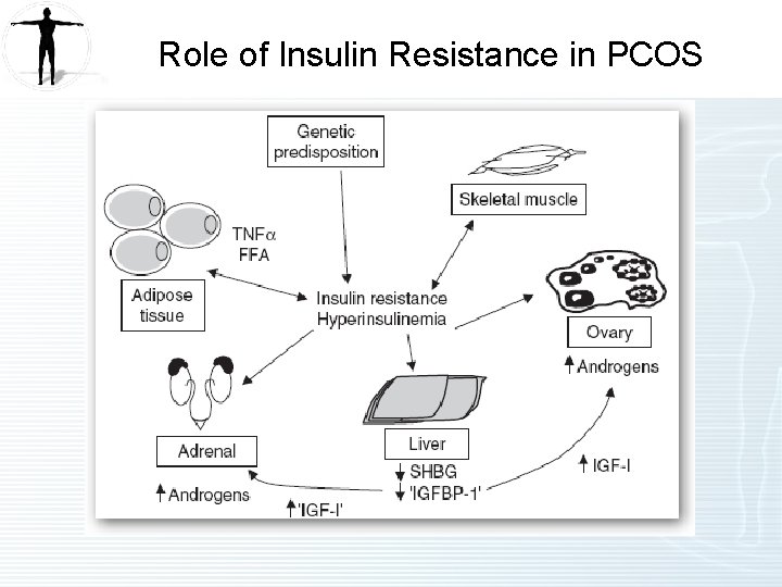 Role of Insulin Resistance in PCOS 