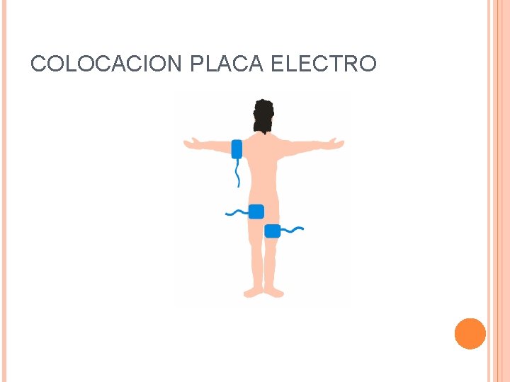 COLOCACION PLACA ELECTRO 