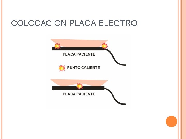 COLOCACION PLACA ELECTRO 