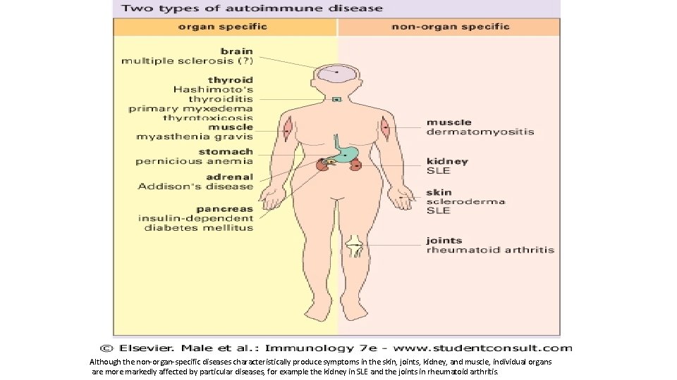 Although the non-organ-specific diseases characteristically produce symptoms in the skin, joints, kidney, and muscle,